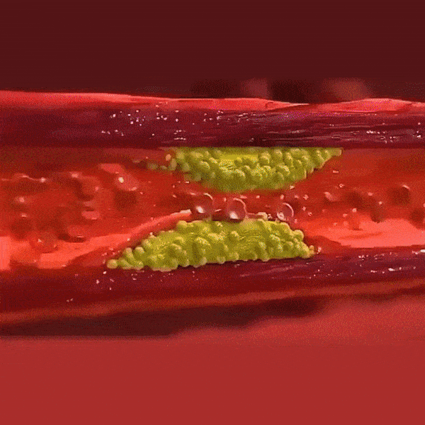 Combo Tapete Estimulador para Pies + Masajeador Mariposa